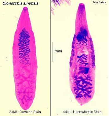  Clonorchis Sinensis: En Inkråmrad Parasit Som Livnär Sig På Människoars Galblase Och Lever!