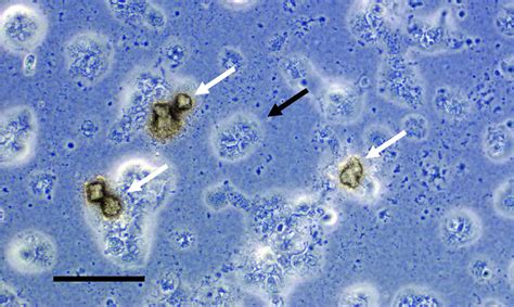  Uroplasma urealyticum - En liten parasit med ett stort problem för vår hälsa!