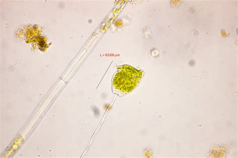   Vorticella - En mikroskopisk virvelvind av liv! 